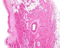 micrograph of sinus node